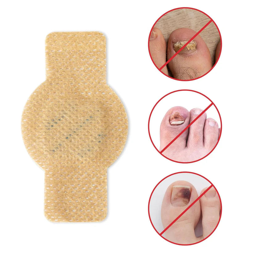 Fungal Nail Treatment Patches- Restore Healthy Nails Fast! 🩹 🔥(BUY 1 GET 1 FREE)