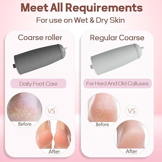 Electric Callus Remover & Pedicure Tool – Salon-Smooth Feet at Home in Minutes